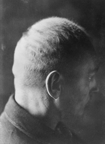 Berlin, o.D., Kurt Michaelis ließ die Spuren der Misshandlungen fotografieren, Landesarchiv Berlin